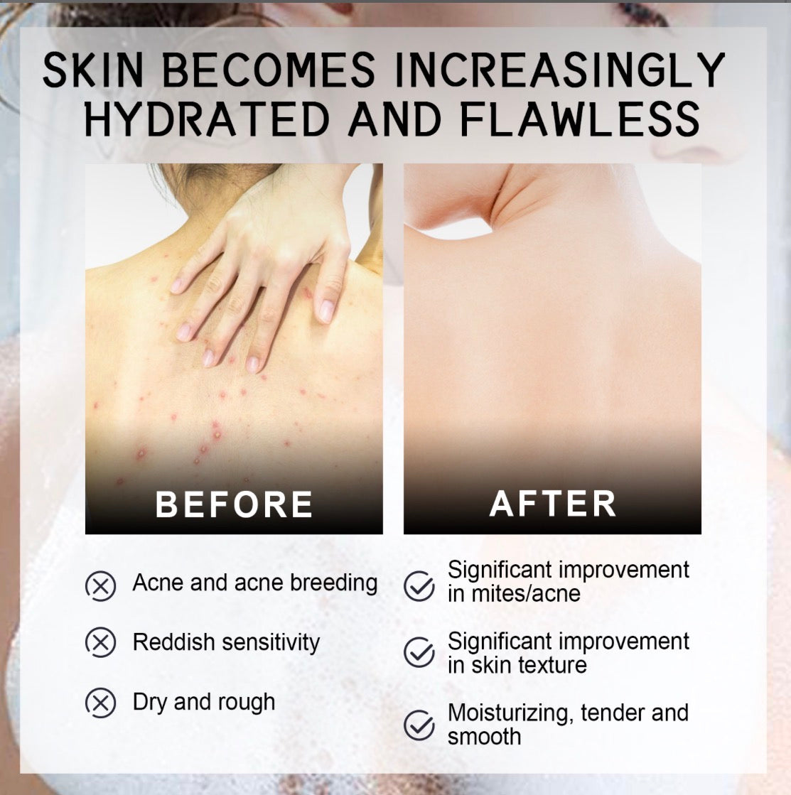 ClearBack Acne Cleansing Bar