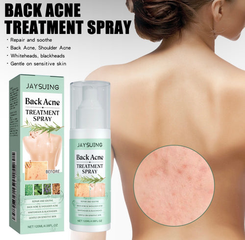 ClearBack Acne Spray