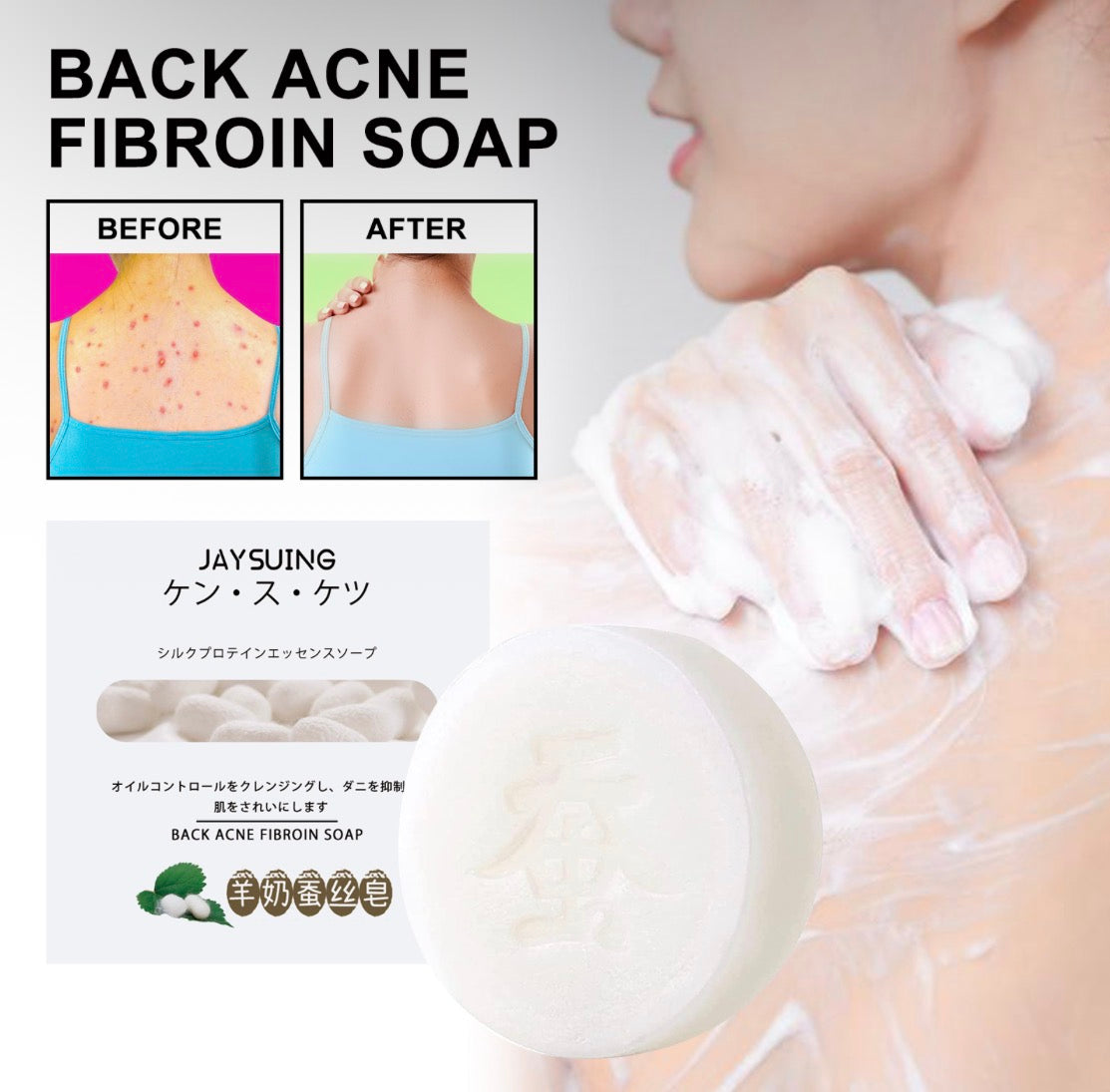 ClearBack Acne Cleansing Bar